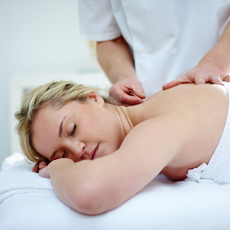 lady getting acupuncture